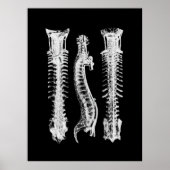 Kunst met anatomie van wervelkolom poster (Voorkant)
