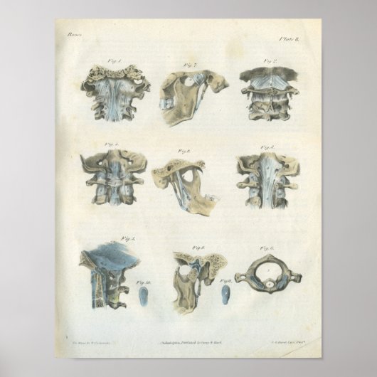 Kunstchiropraktijk met bovenleer-baarheids- en TMJ Poster (Voorkant)