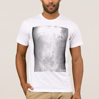 L-5/S1 CT Scan-paraled-by KLM T-shirt