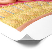 Levering foetus met vacuümextractie poster (Hoek)