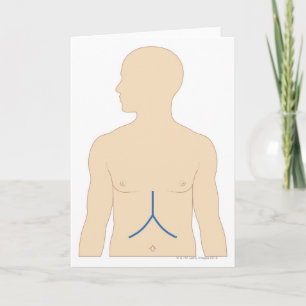 Levertransplantatie Kaart