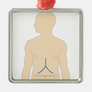 Levertransplantatie Metalen Ornament