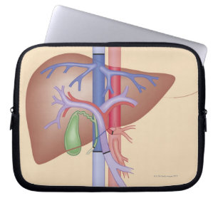Levertransplantatieprocedure Laptop Sleeve
