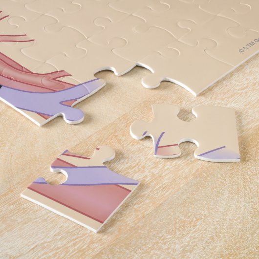 Levertransplantatieprocedure Legpuzzel (Zijkant)