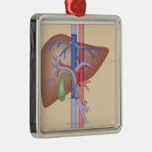 Levertransplantatieprocedure Metalen Ornament (Rechts)