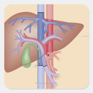 Levertransplantatieprocedure Vierkante Sticker