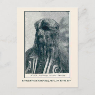 Lionel, de Lion Faced Boy Kaarten en Briefkaarten