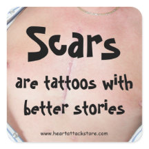 Littekens zijn tattoos met een beter verhaal