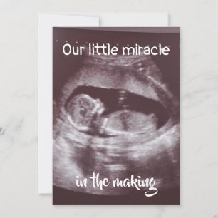 Little Miracle Ultrasound 2 foto Baby familie Aankondiging