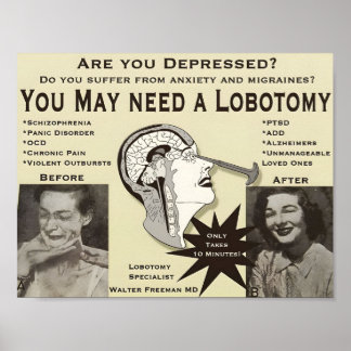 Lobotomie Adverteren Poster | Vintage advertentie 