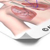 Longziekte COPD-gelabeld Poster (Hoek)