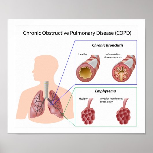 Longziekte (COPD) Poster (Voorkant)