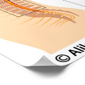 Lumbar epidurale injectie, met een schema. poster (Hoek)