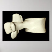 Lumbar Vertebra 4 Poster (Voorkant)