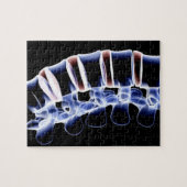 Lumbar Vertebrae 2 Legpuzzel (Horizontaal)