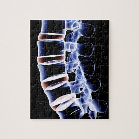 Lumbar Vertebrae 2 Legpuzzel (Verticaal)