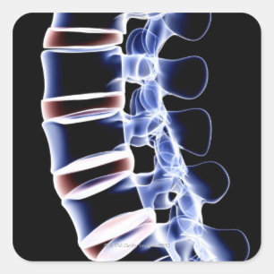 Lumbar Vertebrae 2 Vierkante Sticker