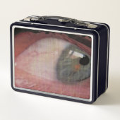 Lunch Box déformation oculaire (Dos)