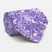 Lung Small Cell Carcinoma Stropdas (Opgerold)