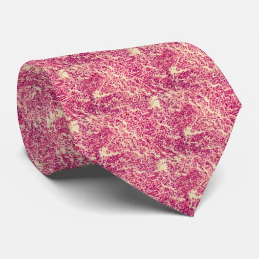 Lymfknoopcellen onder de microscoop. stropdas (Opgerold)