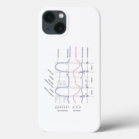Maagdarmstelselaandoeningen linkerventrikel Case-Mate iPhone case (Achterkant)