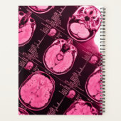 Magenta MRI : Une vue de l'axe du cerveau (Dos)