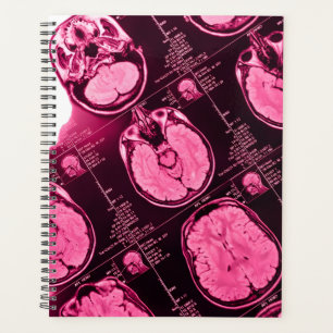 Magenta MRI : Une vue de l'axe du cerveau