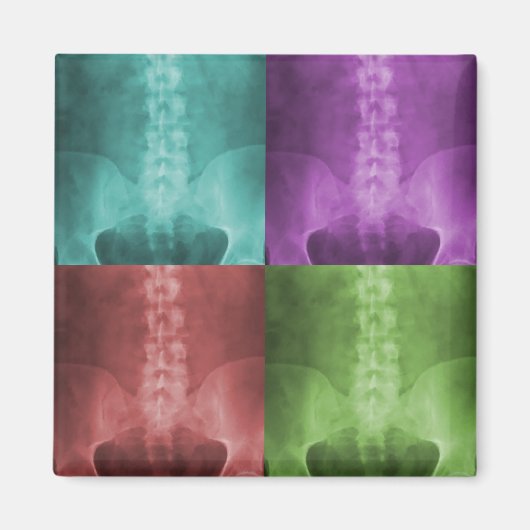 Magnet d'art numérique X-Ray (Devant)