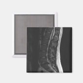 Magnet de disque en série (Recto/Verso)