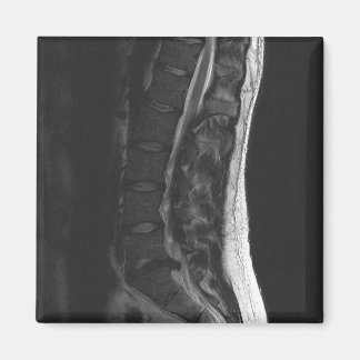 Magnet de disque en série