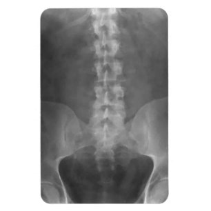 Magnet Flexible Aimant de prime d'art de rayon X de Digitals