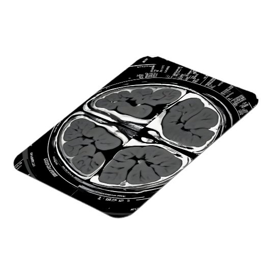 Magnet Flexible Analyse cérébrale par IRM (Côté Gauche)