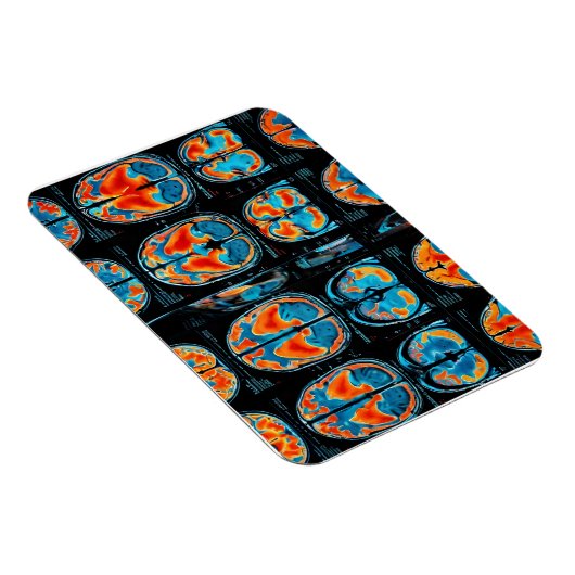 Magnet Flexible Analyse cérébrale par IRM (Côté Droit)