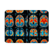 Magnet Flexible Analyse cérébrale par IRM (Horizontal)