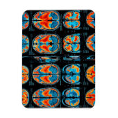 Magnet Flexible Analyse cérébrale par IRM (Vertical)