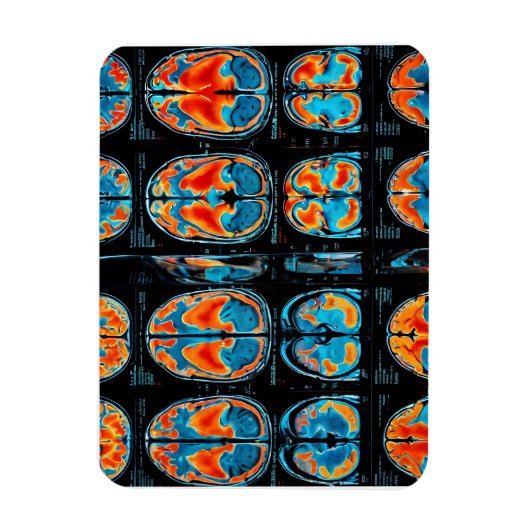 Magnet Flexible Analyse cérébrale par IRM (Vertical)