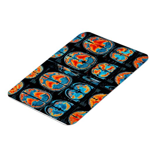 Magnet Flexible Analyse cérébrale par IRM (Côté Gauche)