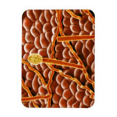 Magnet Flexible Fungus de poudrière sur Poinsettia (Vertical)