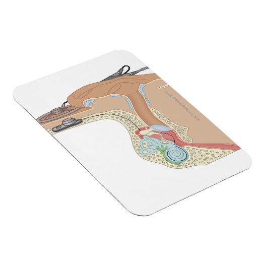 Magnet Flexible Implants cochléaires (Côté Droit)