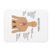 Magnet Flexible Principales complications d'une forte pression art (Horizontal)