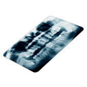 Magnet Flexible Rayon X des dents (Côté Gauche)
