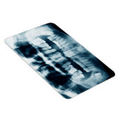 Magnet Flexible Rayon X des dents (Côté Droit)