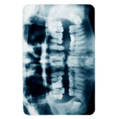 Magnet Flexible Rayon X des dents (Vertical)