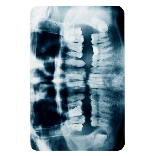 Magnet Flexible Rayon X des dents (Vertical)