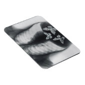 Magnet Flexible rayons X de papillons dans l'estomac (Côté Droit)