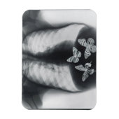 Magnet Flexible rayons X de papillons dans l'estomac (Vertical)