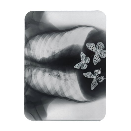 Magnet Flexible rayons X de papillons dans l'estomac (Vertical)