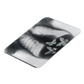 Magnet Flexible rayons X de papillons dans l'estomac (Côté Gauche)