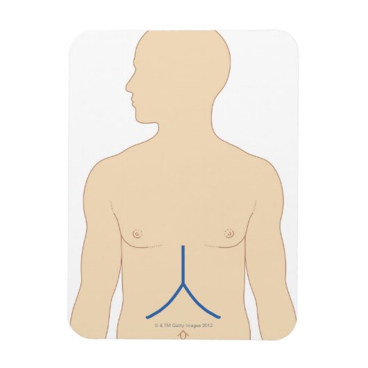 Magnet Flexible Transplantation du foie (Vertical)