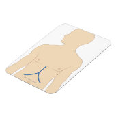 Magnet Flexible Transplantation du foie (Côté Gauche)